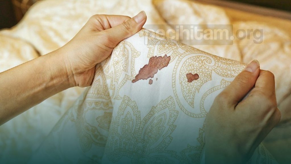 Bisakah Wanita Haid Saat Hamil Bagaimana Status Hukumnya Dalam Fiqih